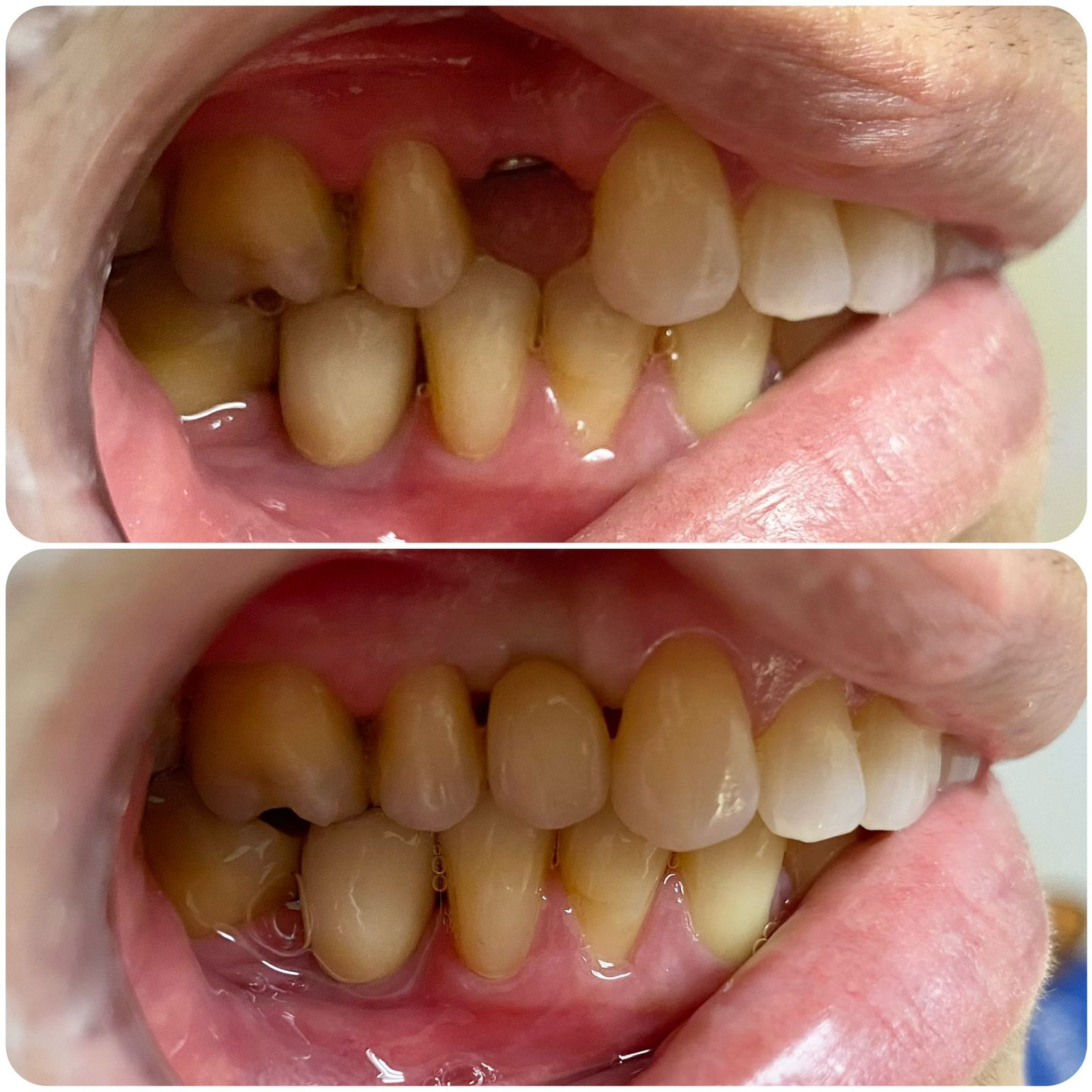 Sorridents-implantes-01