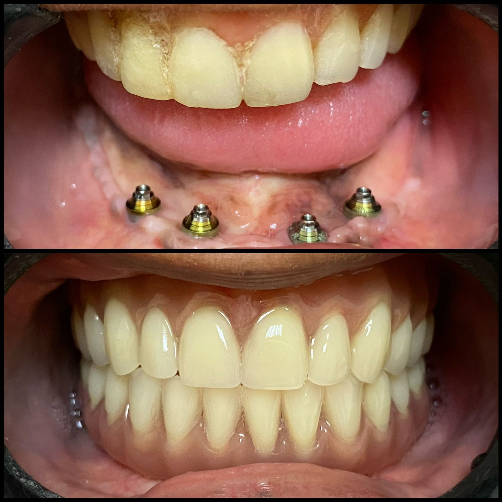 Sorridents-implantes-02